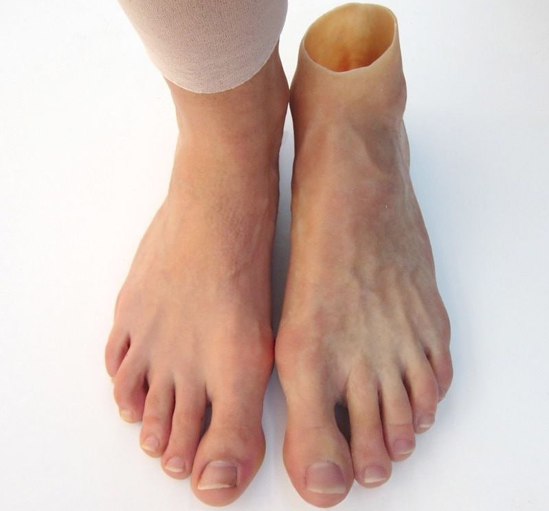 Silicone Cosmetic Prosthetics