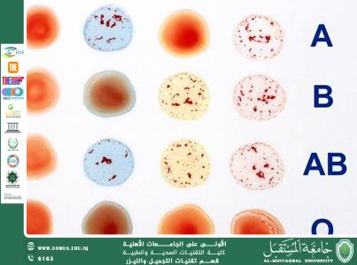 مقاله علميه للست هدى رافد عبد الخالق بعنوان اهمية معرفه فصيلة دمك