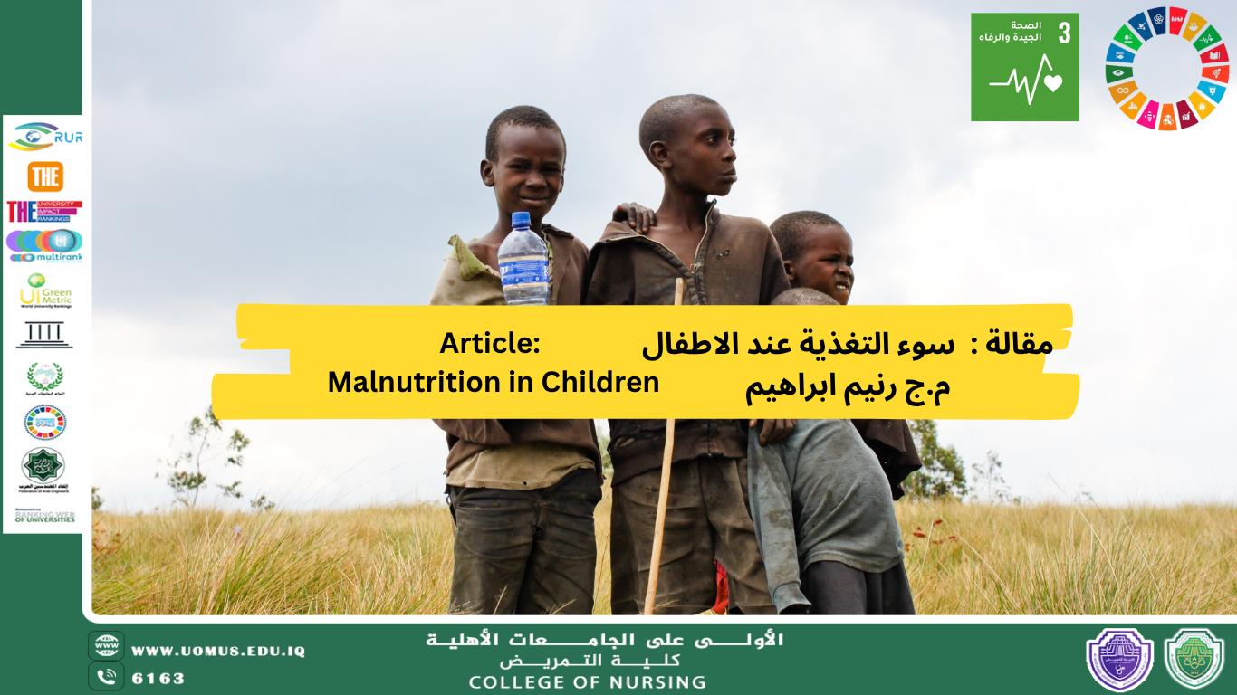 Article: Malnutrition in Children