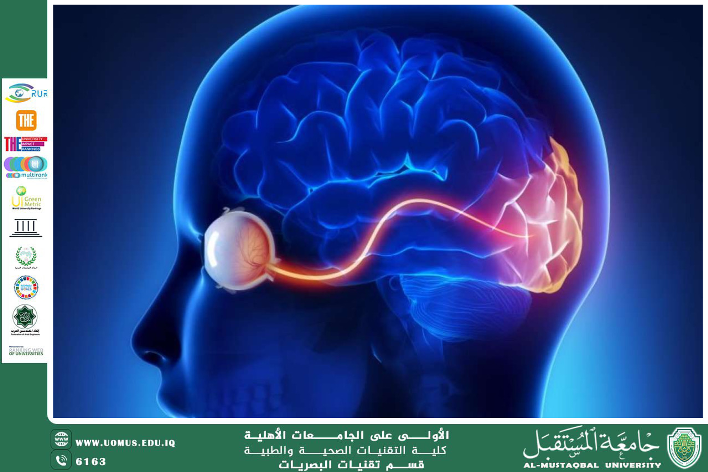  A scientific article by the lecturer, Asst. Lecturer Hassan Qahtan Kazem Al-Hussein (Optic Nerve Damage: Causes, Symptoms, Diagnosis, and Treatment)
