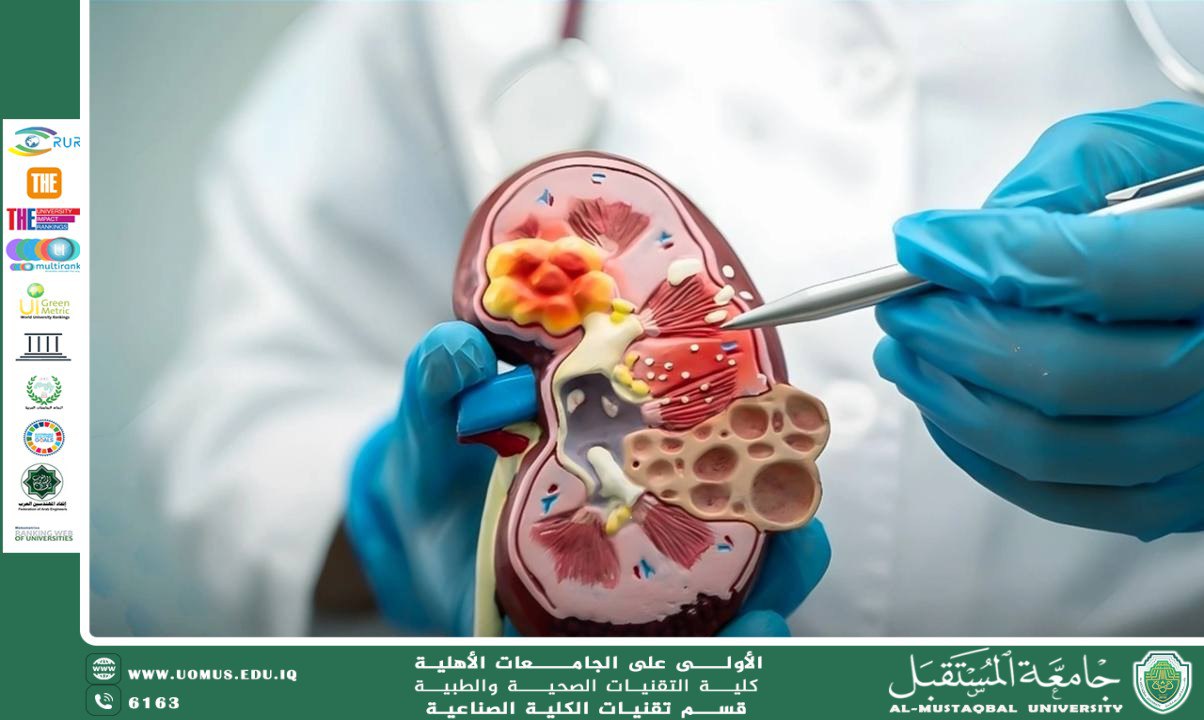 Causes of Elevated Urea in the Blood