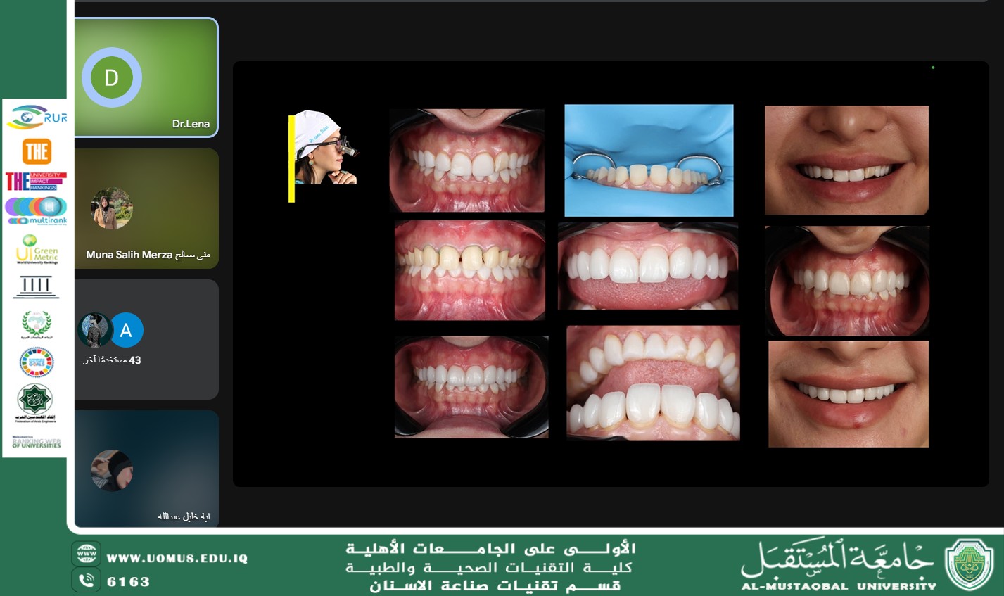 ورشة علمية تسلط الضوء على المعايير الذهبية في تنفيذ التيجان والجسور السنية