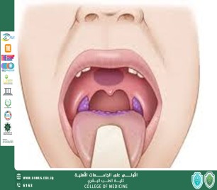 مقالة بعنوان  المؤشرات الحيوية في الدم أو اللعاب أو الأنسجة لسرطان الخلايا الحرشفية في البلعوم الفموي