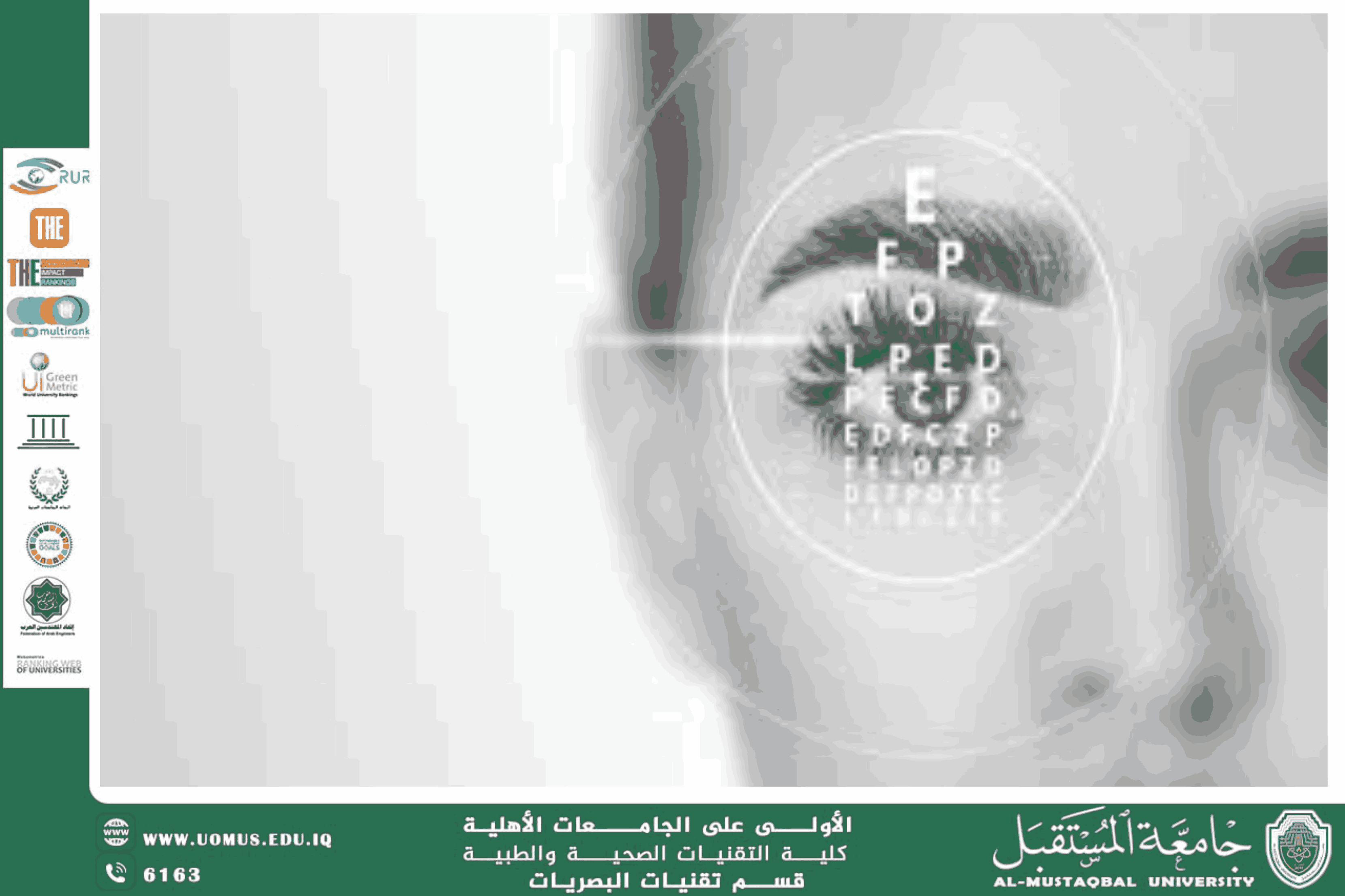  A scientific article by the lecturer, Assist.Lect. Ali Hadi Al-Husseini (Impact of Crystalline Lens Disorders on Binocular Vision and Ocular Accommodation in Adults)