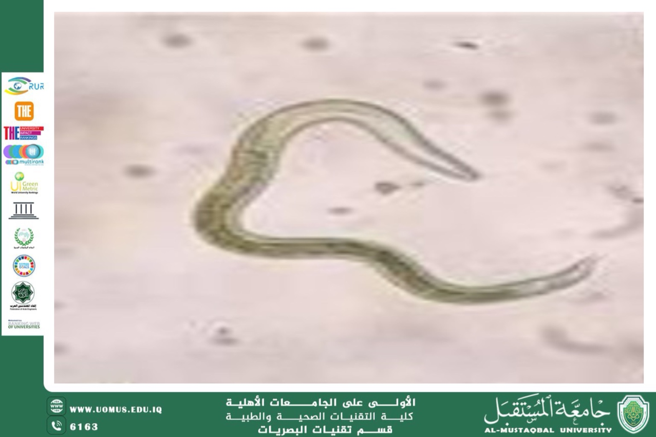 A scientific article by Assistant Lecturer Hassan Qahtan titled ( The Impact of Ascaris (Toxocara canis) on the Eye)