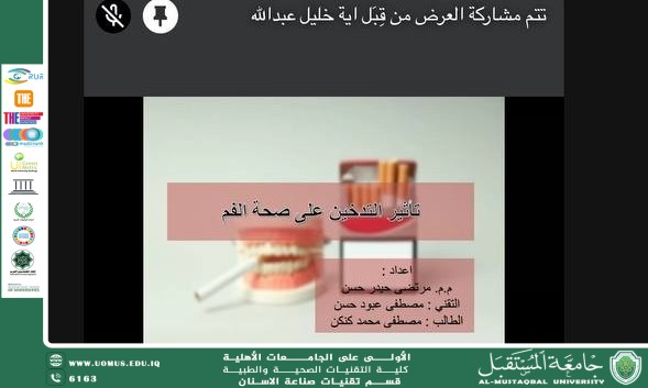 ورشة علمية بعنوان (( تأثير التدخين على صحة الفم )) 