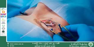 Ophthalmic Surgery as a Key Application of Laser Technology  (Asst. Prof. Dr. Sami Abdul Hussein Habana)