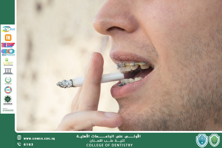 The Impact of Smoking on Fixed Orthodontic Treatment